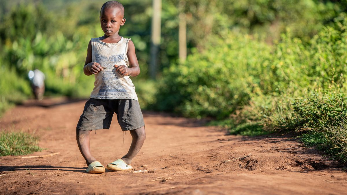 Ein etwa vierjähriger Junge mit etxremen O-Beinen geht einen unbefestigten Weg entlang.