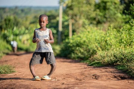 Ein etwa vierjähriger Junge mit etxremen O-Beinen geht einen unbefestigten Weg entlang.