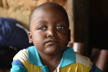 Kleiner afrikanischer Junge mit weißen Pupillen