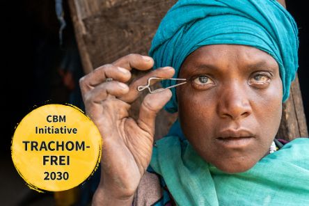 Eine Frau mit buntem Koptuch und geröteten Augen hält eine Pinzette an ihre Wimpern.