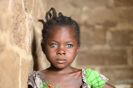 Ein etwa achtjähriges Mädchen steht vor einer gemauerten Zimmerwand. Das Kind hat auffallend weiße Pupillen.