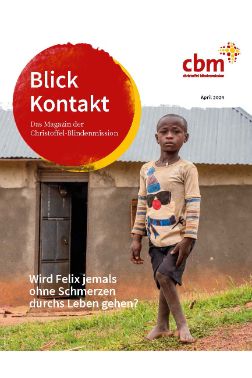 Ein kleiner Junge mit X-Beinen steht vor einem kleinen Haus mit Wellblechdach.