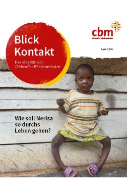 Ein etwa fünjähriges Mädchen mit extremen O-Beinen steht vor einer Bretterwand. Auf dem Bild ist ein roter Punkt, auf dem &quot;BlickKontakt&quot; steht.