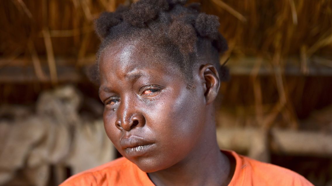 Frau mit roten Augen schaut in die Kamera