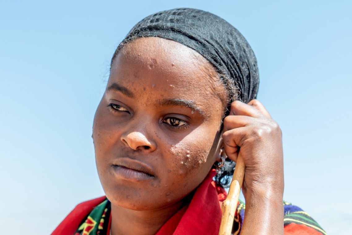 Porträt einer jungen Frau, die einen Stock in der linken Hand hält.