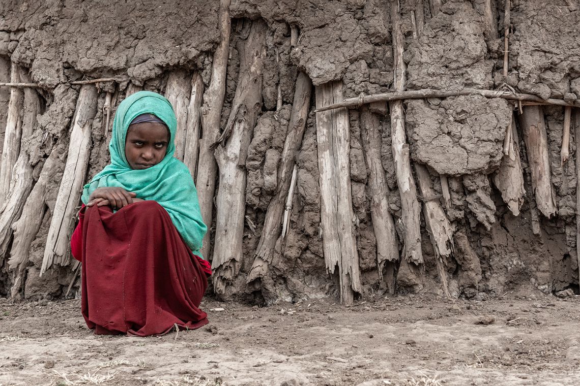 Ein etwa neunjähriges Mädchen kauert alleine vor einer Lehmhütte. Es hat auffällig helle Pupillen.