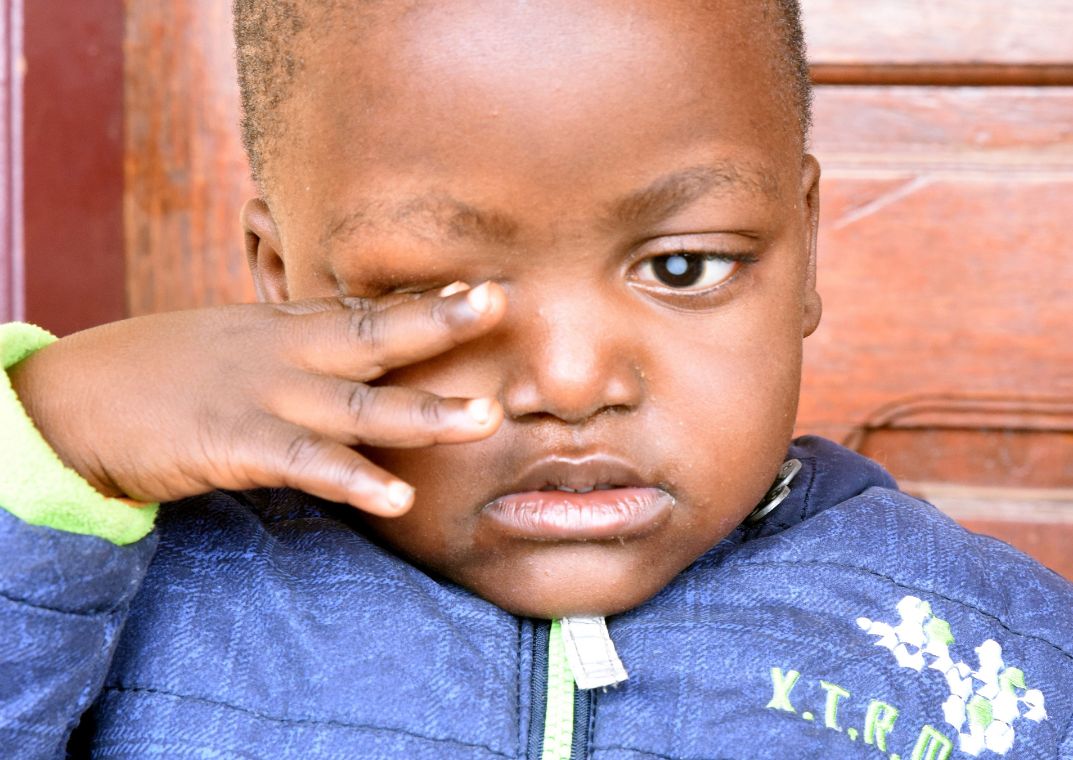 Kleiner afrikanischer Junge mit weiß schimmernden Pupillen