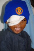Mädchen aus Tansania mit Augenverband