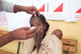 Äthiopische Frau wird an den Augen untersucht