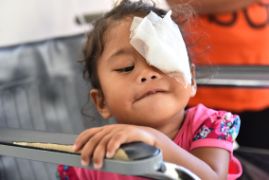 Kleines philippinisches Mädchen mit Augenverband