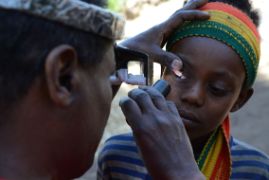 CBM-Mitarbeiter untersucht Mädchen an den Augen.