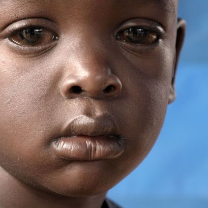 Traurig blickendes Kind mit trüben Augen