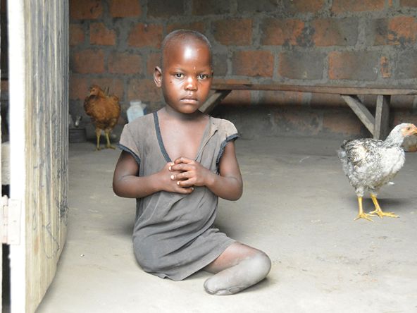 Ein beinamputiertes afrikanisches Mädchen sitzt auf dem Boden einer Hütte, neben ihm ein Huhn.