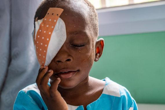 Ein etwa dreijähriger Junge mit Augenverband fasst sich mit der Hand an die Wange.