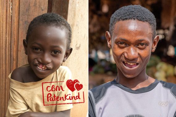 Zwei Mal das Gesicht derselben Person – einmal des kleinen Jungen und eimal des jungen Mannes. Das Kind hat eine Kiefer-Gaumen-Lippenspalte, der junge Mann nicht.
