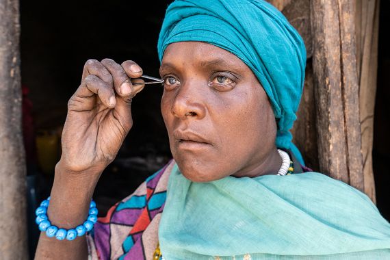 Eine Frau mit buntem Koptuch und geröteten Augen reißt mit einer Pinzette eine ihrer Augenwimpern aus.
