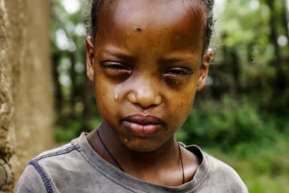 Ein kleines Mädchen kneift die Augen zu. Es lehnt sich an einen Holzpfosten.