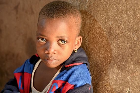 DIe kleine Gaelle aus Kamerun hat Grauen Star und kann kaum noch etwas sehen. 