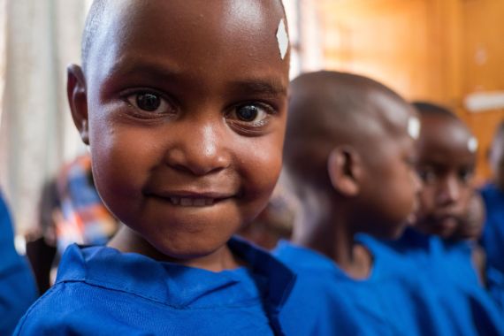 Ein kleines lächelndes Mädchen mit einem Pflaster überm linken Auge, im Hintergrund weitere Kinder. Dank Spenden von Firmen und Unternehmen verschiedener Rechtsformen wie Gmbh u.a. können wir diesen Kindern mit Augenoperationen helfen.