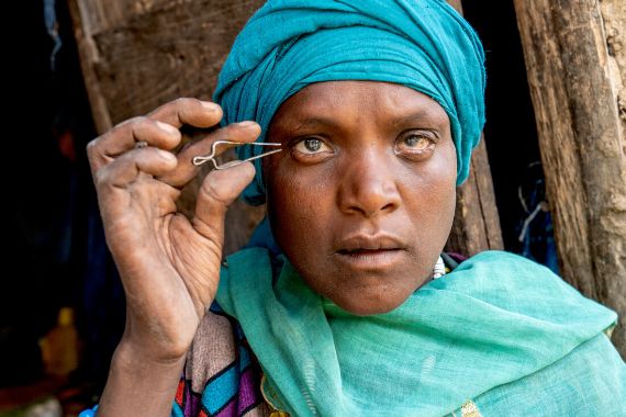 Eine Frau mit Kopftuch, die eine Pinzette nah an ihr Auge hält. 