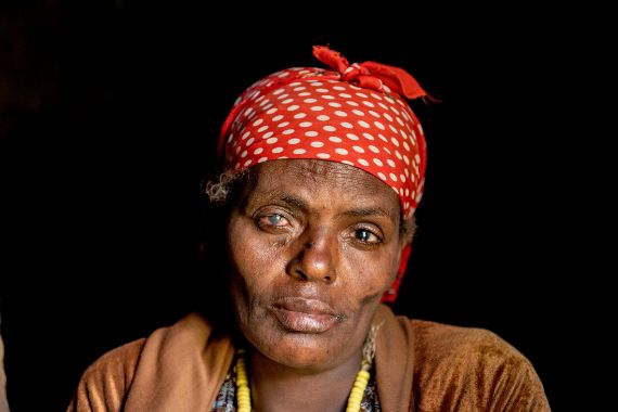 Eine Frau mit Kopftuch und entzündeten Augen. 