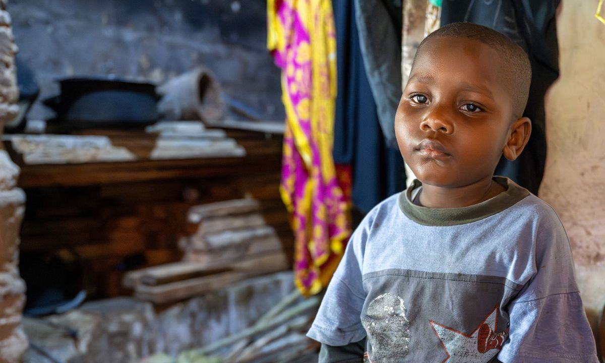 Ein etwa vierjähriges Kind hat hell schimmernde Pupillen.