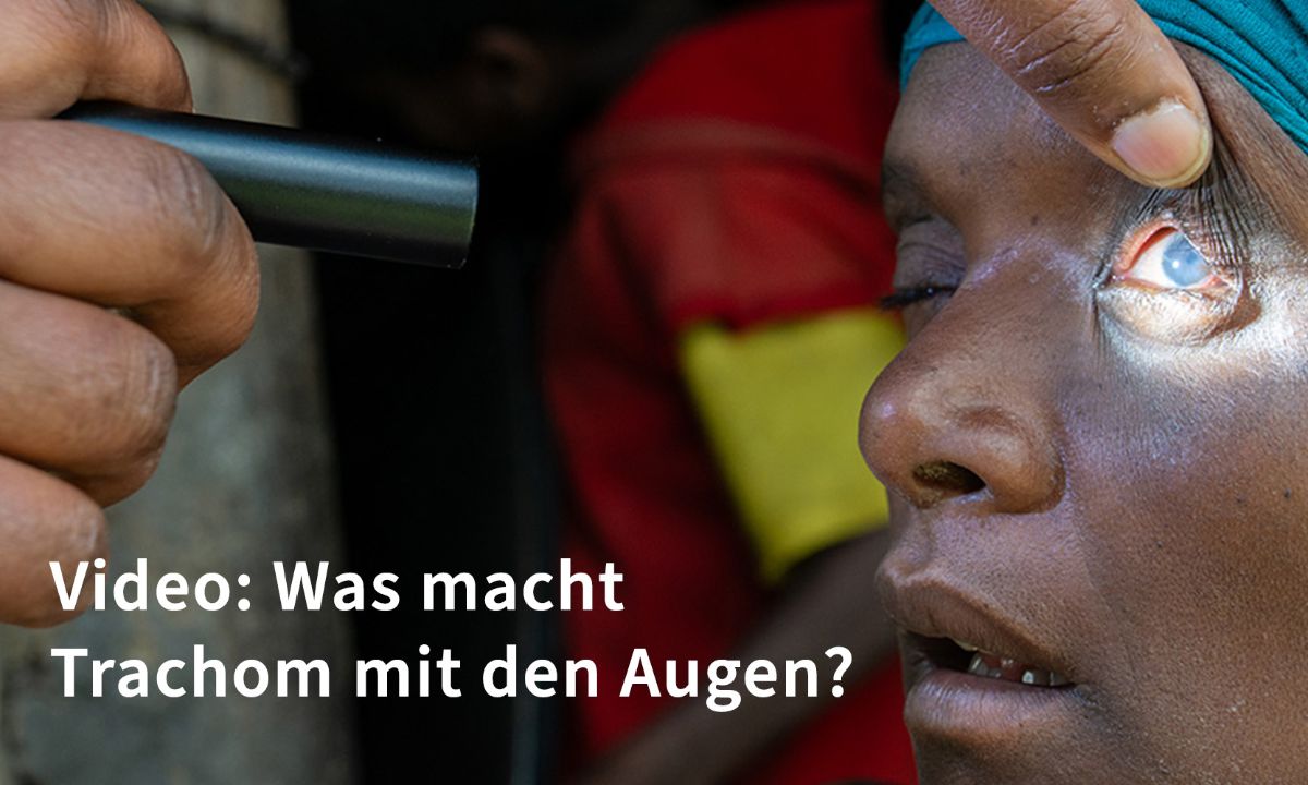 Videobutton: Was macht Trachom mit den Augen?