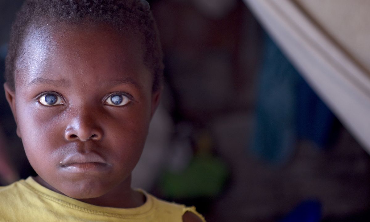 Ein Junge mit auffallend weißen Pupillen.