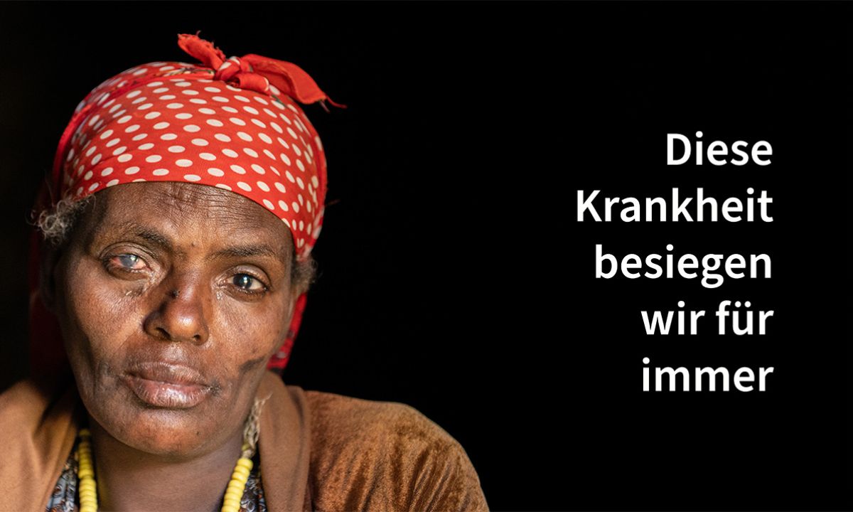 Eine Frau mit Koptuch und getrübten Augen, daneben der Schriftzug: Diese Krankheit besiegen wir für immer.