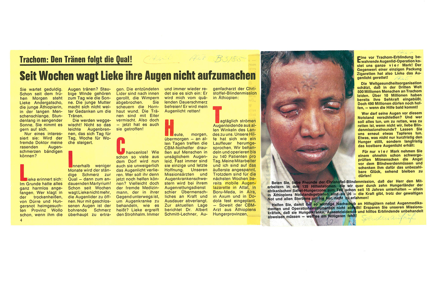 Frau mit geschwollenen Augenlidern