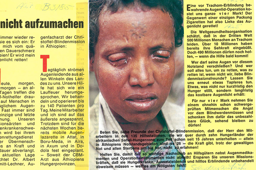 Frau mit geschwollenen Augenlidern